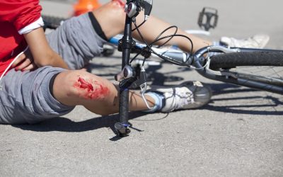 Slip and Fall Lawyers in Peoria AZ Help You Determine if You Have a Case