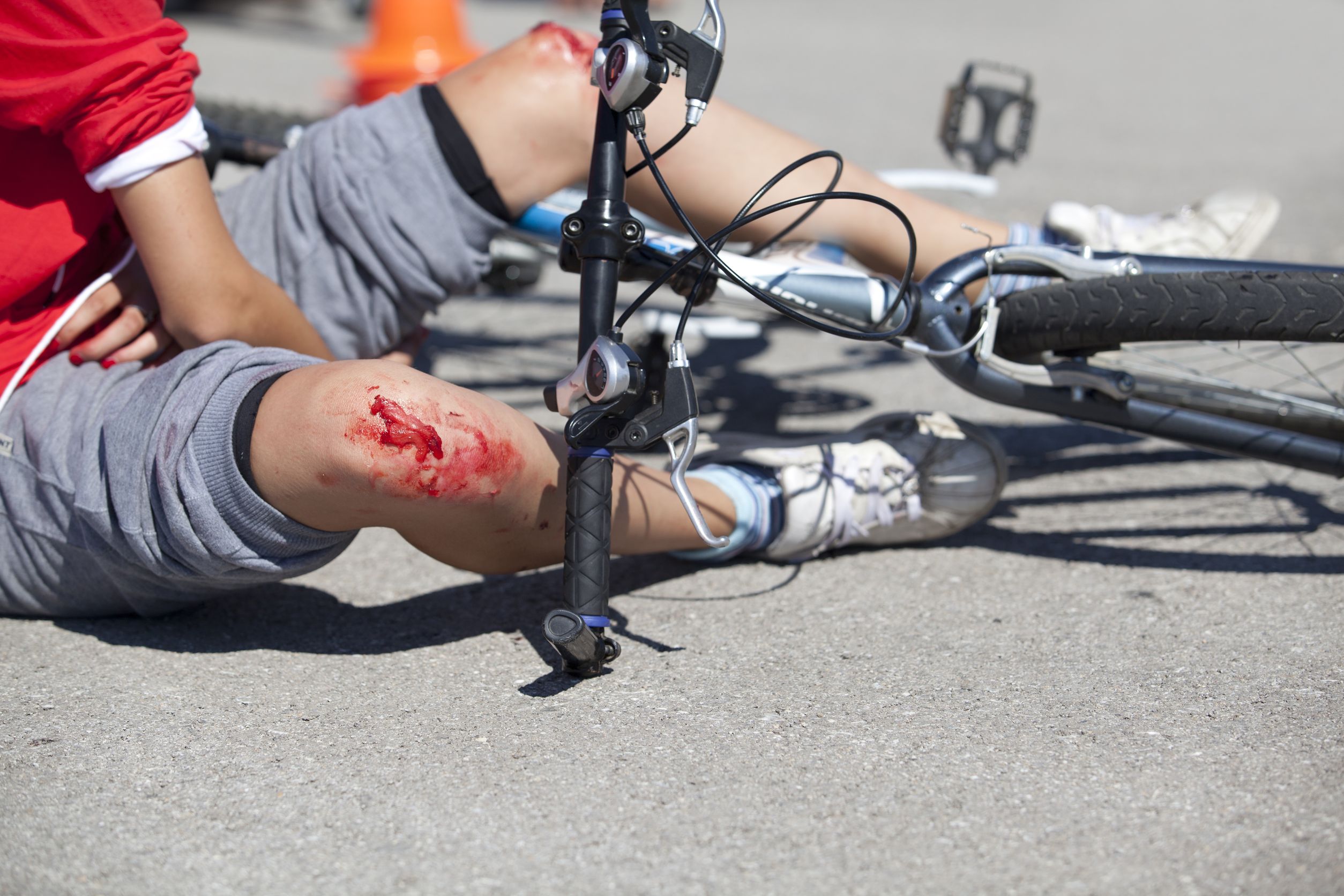 Slip and Fall Lawyers in Peoria AZ Help You Determine if You Have a Case